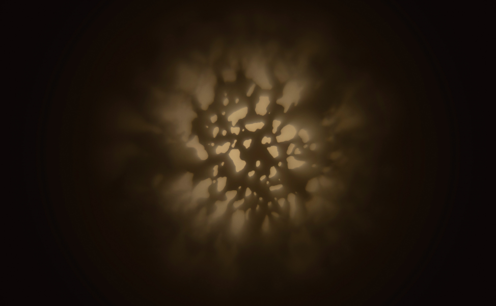 パターン1（こもれび柄）のイメージ画像